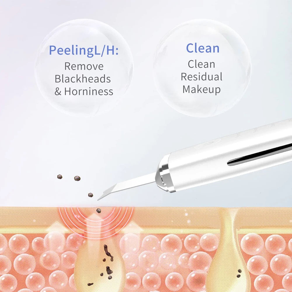 Electric Skin Scrubber Peeling Blackhead Remover